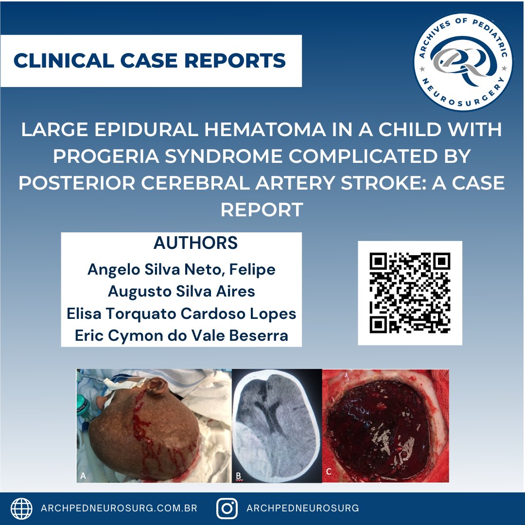 Clinical case report! Available online!

#neurosurgery #pediatricneurosurgery

@abecbrasil @flanc.neurocirugia @sbn.neurocirurgia @sbnped @wfns_neurosurgery