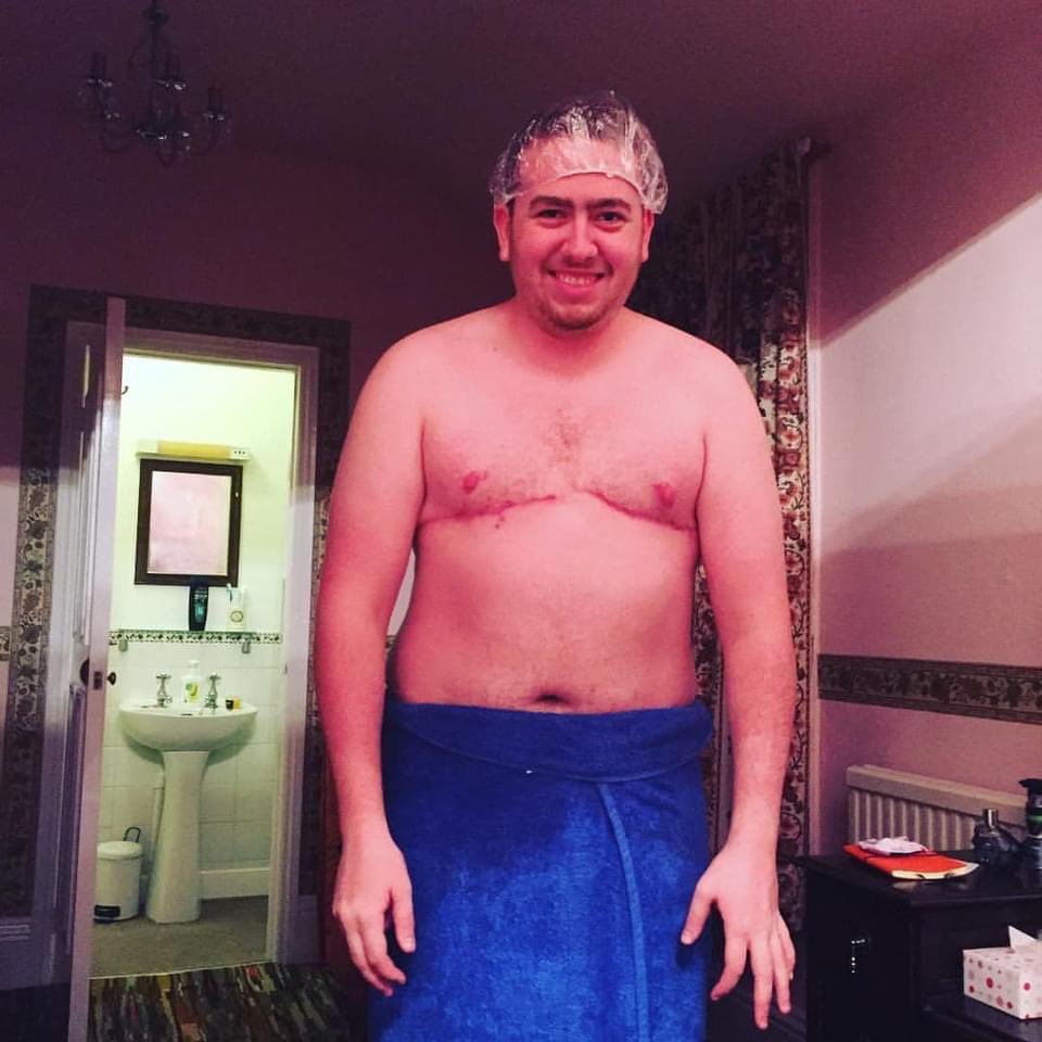 disabledtudor's tweet photo. 9 years ago today I had top surgery as part of my gender transition.
My top surgery was delayed by 2 years.
My top surgery had been life saving. Happy with the results too
The pictures are from meter to the time of my surgery. Not got more recent ones.
#NonBinaryTransMan https://t.co/NJpQdnTLCp
