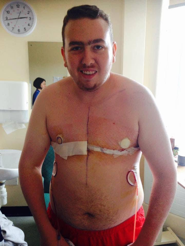 disabledtudor's tweet photo. 9 years ago today I had top surgery as part of my gender transition.
My top surgery was delayed by 2 years.
My top surgery had been life saving. Happy with the results too
The pictures are from meter to the time of my surgery. Not got more recent ones.
#NonBinaryTransMan https://t.co/NJpQdnTLCp