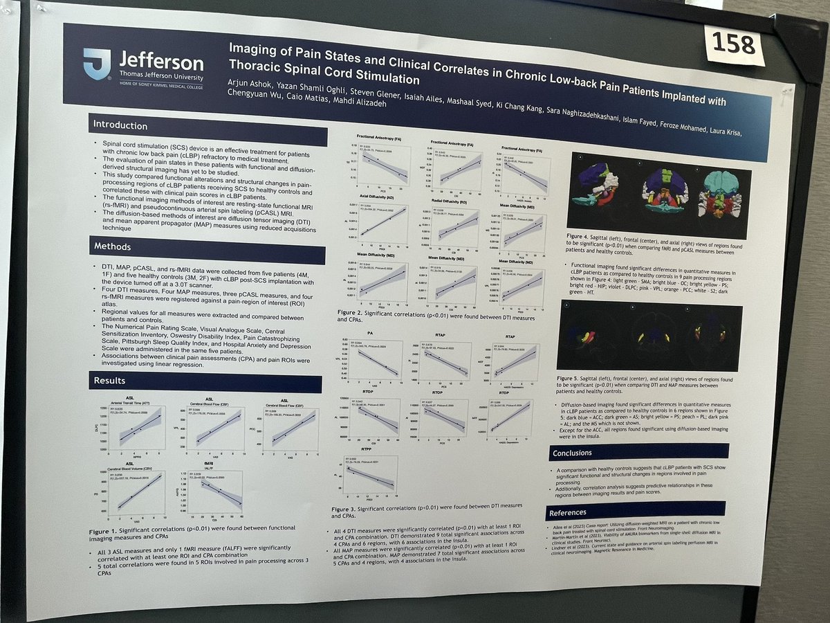 Some of our work at #ASSFN2024 <a href="/ASSFNeurosurg/">ASSFN</a> 
<a href="/TJUHNeurosurg/">Jefferson Neurosurgery</a> @ChenWuMD <a href="/KevinJHinesMD/">Kevin Hines</a> <a href="/islamfayed/">Islam Fayed, MD,MS</a> <a href="/AshSharan/">Ashwini Sharan, MD</a> <a href="/caiommatias/">Caio Matias</a>