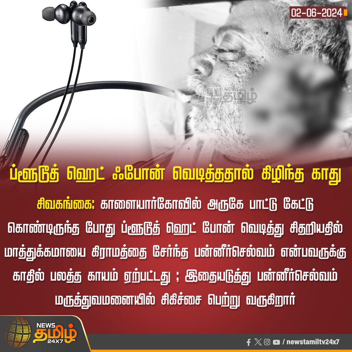 NewsTamilTV24x7's tweet photo. #NewsUpdate | ப்ளூடூத் ஹெட் ஃபோன் வெடித்ததால் கிழிந்த காது
Click Link: https://t.co/5r0UhYUEfn
#HeadPhoneBlast | #BluetoothHeadphone | #sivagangai | #EarDamage | #Newstamil24x7 https://t.co/VHDaeLZLZy