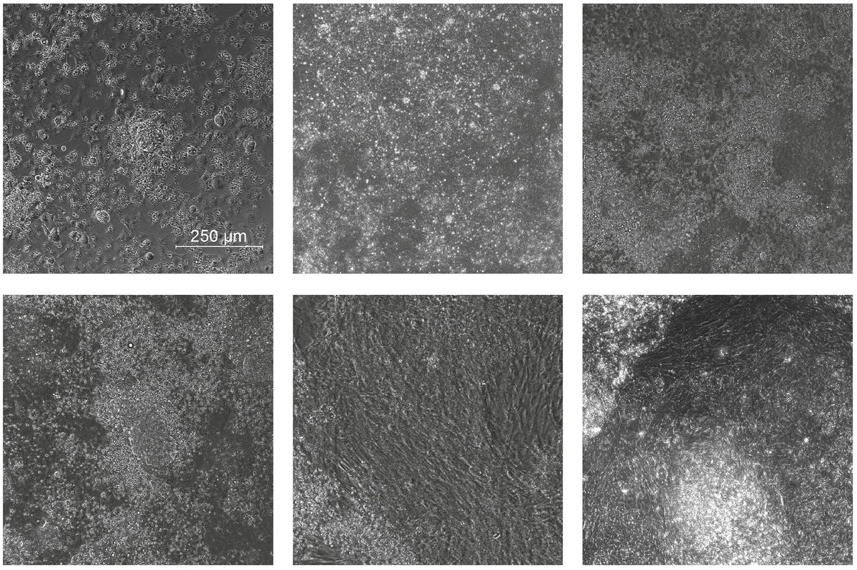 🐔 *cluck* *cluck*  

Check out this study that confirmed that early infection with J avian leukosis virus can accelerate the differentiation of chicken ESCs and promote the secretion of exosomes. 

💬 More here: bit.ly/4e5iRno