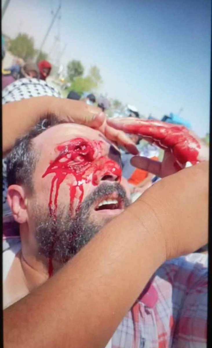 mo1980hand's tweet photo. السيد رئيس مجلس الوزراء محمد شياع السوداني ترضاهة يصير هذا الحال بمهندس بحكومتك هو شيريد غير التثبيت                   عقود وزارة النفط ٣١٥ المظلومة https://t.co/V6IVvaXMDi