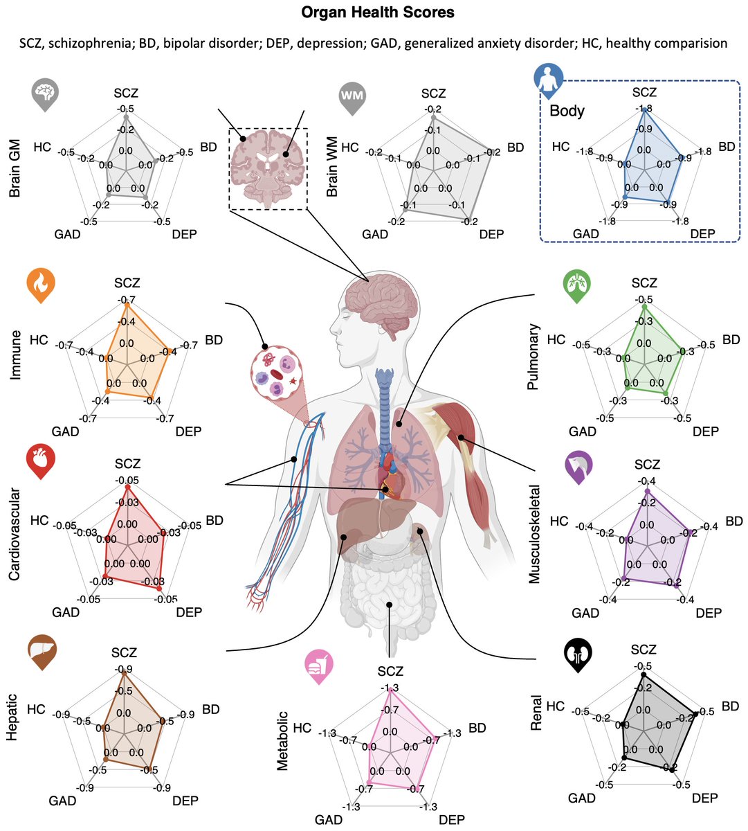 Poor body health is a more pronounced manifestation of mental illness than poor brain health.

🧵1/12