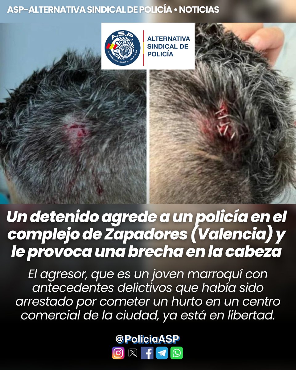 PoliciaASP's tweet photo. 🚨Un detenido agrede a un policía en el complejo de Zapadores y le provoca una brecha en la cabeza.
😤El agresor es un joven marroquí con antecedentes delictivos que había sido arrestado por cometer un hurto en un centro comercial de la ciudad.
#ProfesionDeRiesgoYa
#ASPcontigo https://t.co/Eusm3C1rNY