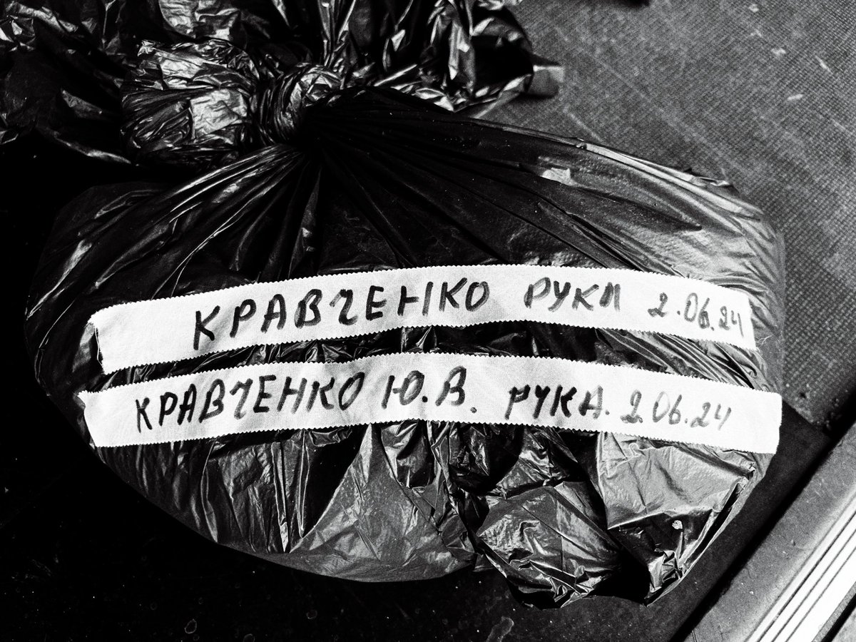 Він дуже тихий. Мало говорить, спокійно. Легко дається, коли треба підключати систему.

Я спитала його чи можу показати його на фото:

- Ну щоб може сімʼю не нервувати, якщо ви їм ще не сказали.

- Та виставляйте. В мене немає сімʼї, - потім показує на руку, - і не буде.