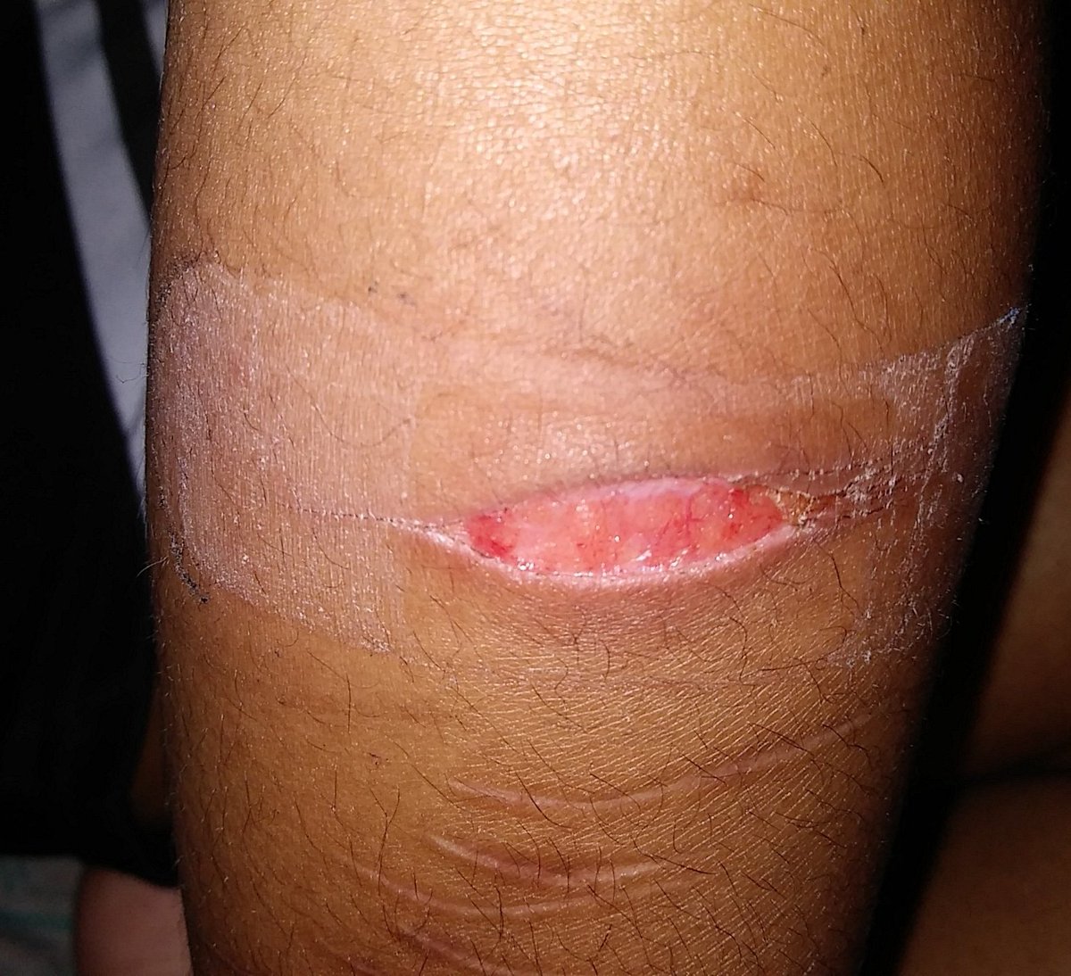 LifesUnpredict's tweet photo. Eww #healing #shtwt #celldivision https://t.co/h4uOCMVDoV