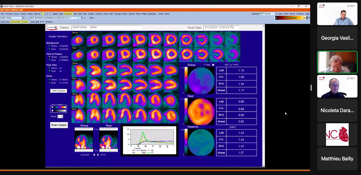 gmvasilakis's tweet image. ⭐️Finishing up our #MPI session with Dr. Bateman and Dr. Calnon sharing cases involving #CAD and #CardiacTransplant

#CVNuc @MyASNC #ThinkPET