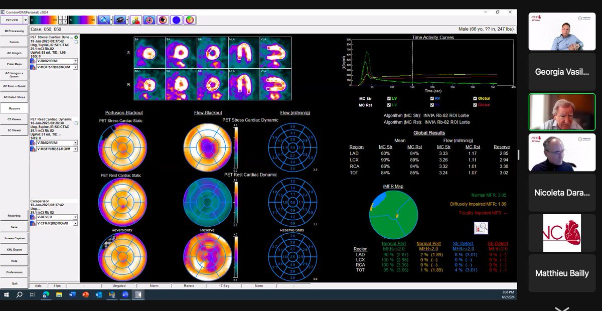gmvasilakis's tweet image. ⭐️Finishing up our #MPI session with Dr. Bateman and Dr. Calnon sharing cases involving #CAD and #CardiacTransplant

#CVNuc @MyASNC #ThinkPET