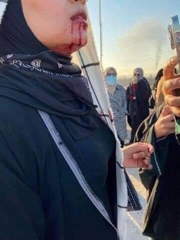 #العراق
2-6 /2024 في ظل حكومة الإطار العباسية 

المشكله اللي يحچي الحق ويطالب بحقه يطلع مو خوش وينهان مو بَـــسْ هنا بكل مكان للاسف واقع حال هذا البلد تحكمة عصابات بني العباس لعنة الله عليهم أجمعيا أعداء الانسانية