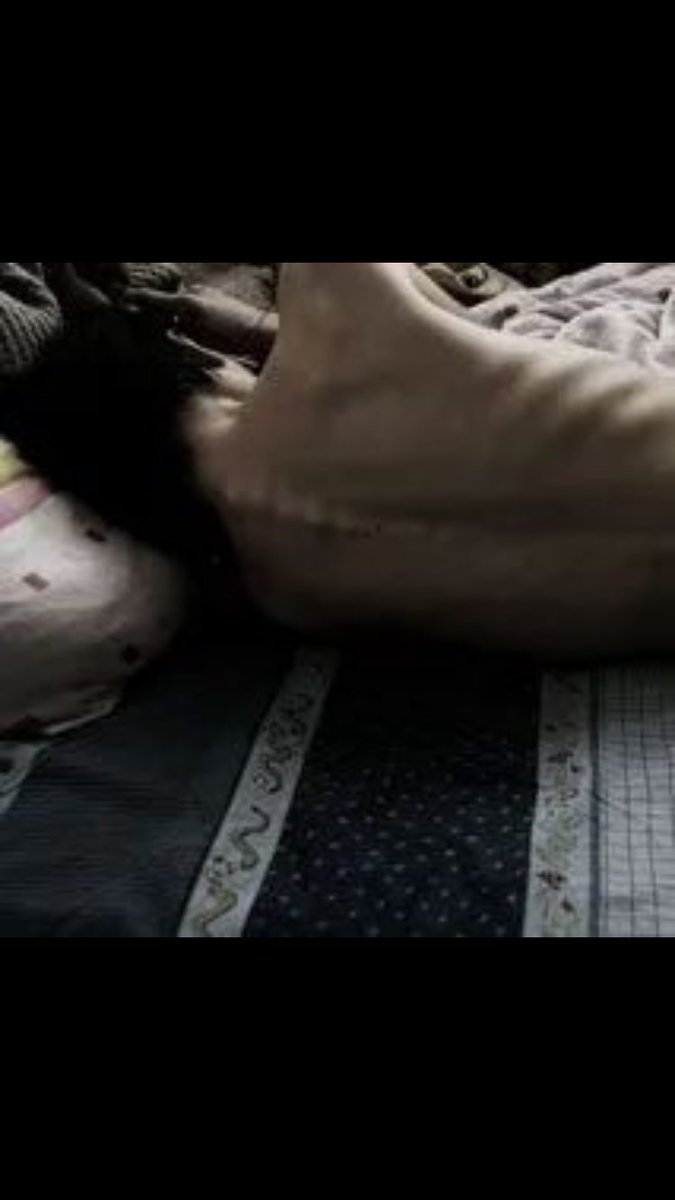 abibunny0's tweet photo. 🔞｡⁠*ﾟ⁠+Fijado hasta pesar 39kg+ *ﾟ｡🔞

#edtwt #thinspo #bonespo https://t.co/zV5VMDj2iS