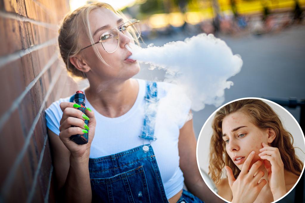 nypost's tweet image. Gen Z’s love for vaping could be the reason they’re ‘aging like milk’: docs trib.al/y0wyfVA