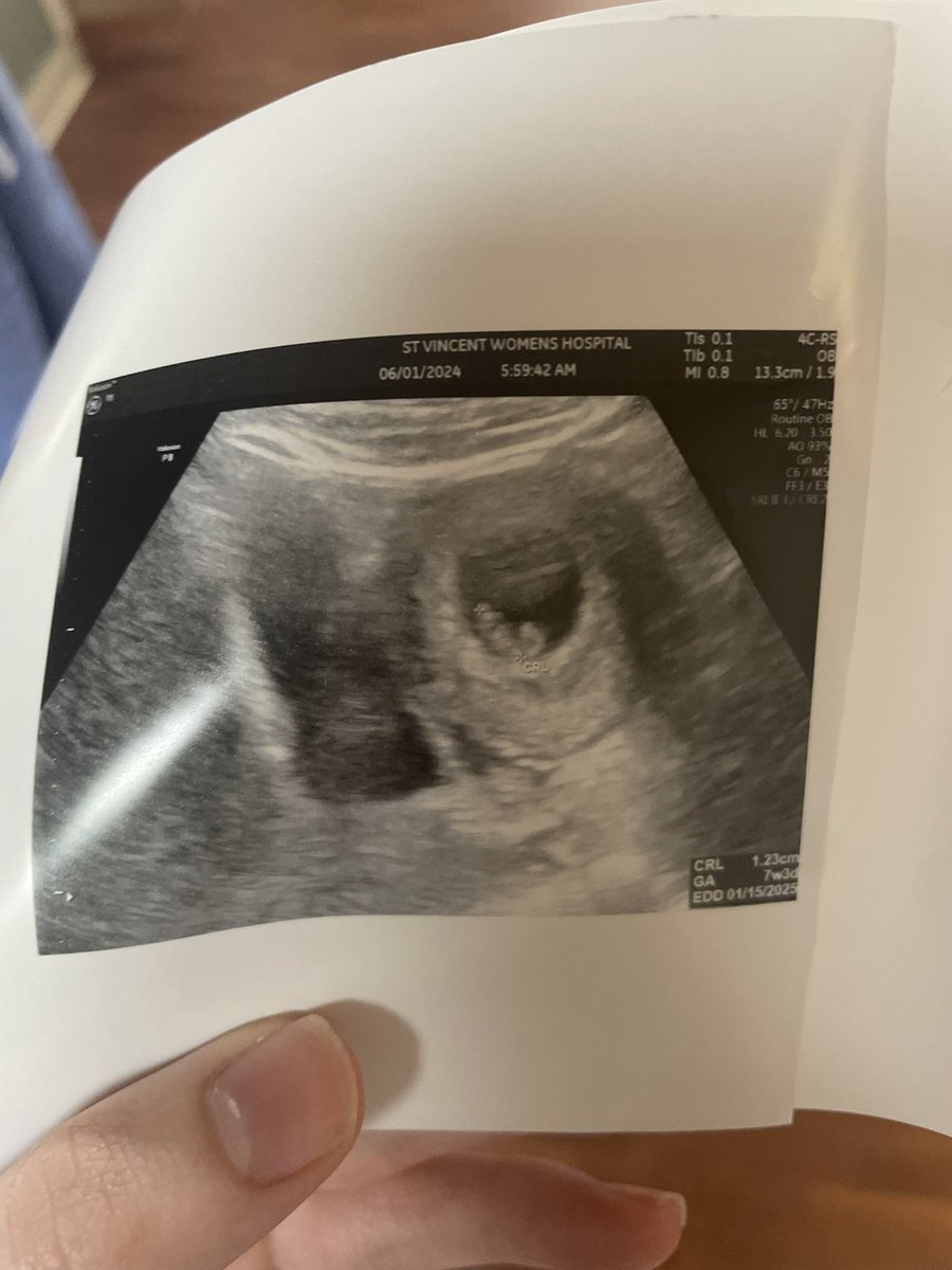 drerincallaghan's tweet image. It’s been a crazy week, but what a beautiful way to come into Corpus Christi with a picture of our little one and to be able to hear their heartbeat. Jesus has given us everything, and as the author of life, he gives us the greatest gifts ❤️