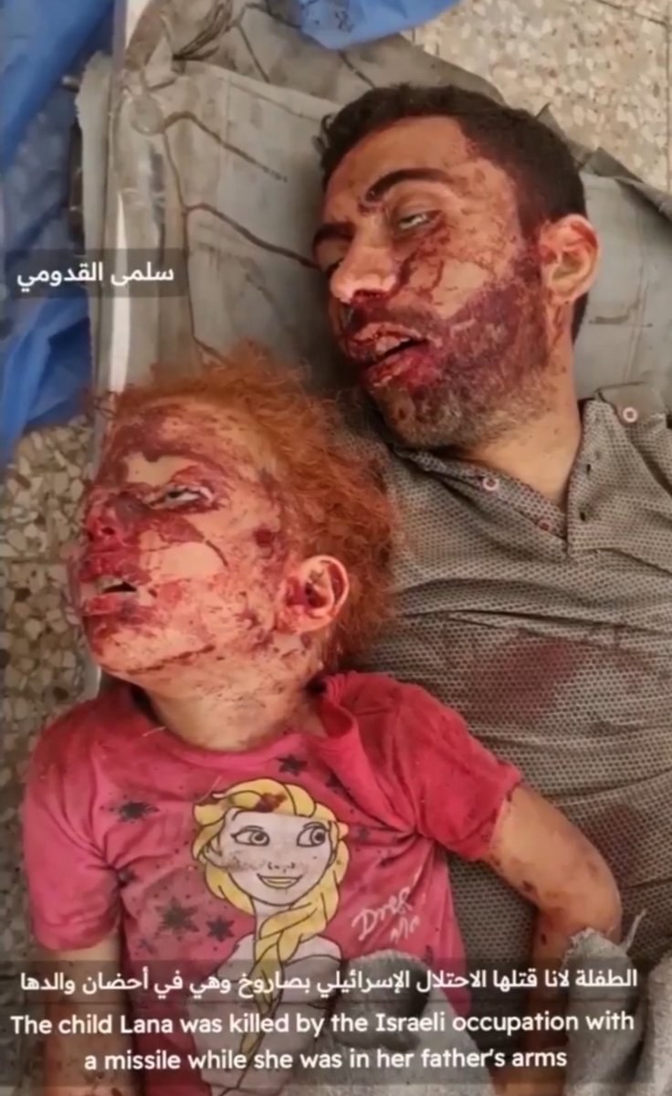 ShaykhSulaiman's tweet photo. THIS IS A GENOCIDE *NSFW https://t.co/qFMh6ZAfz7