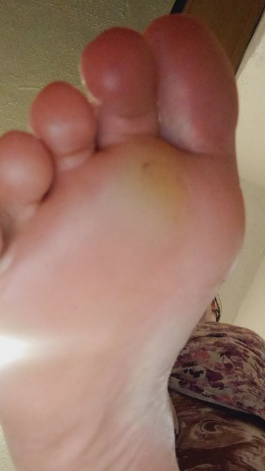 Merry whateverthefuck,  you outdated obsessed feet loving weirdos from colonialistic areas 💦 Appreciation<a href="/tag/feetlovers"class="tags"><span>#feetlovers</span></a>
