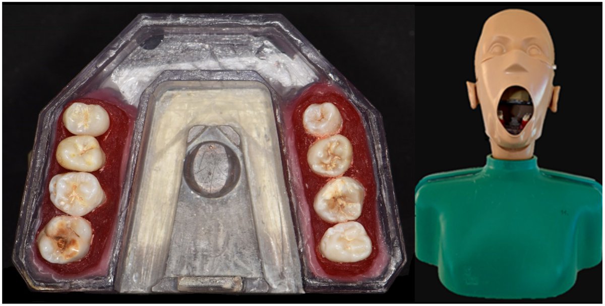 Sensors_MDPI's tweet image. New Caries Diagnostic Tools in Intraoral Scanners: A Comparative In Vitro Study to Established Methods in Permanent and Primary Teeth
mdpi.com/1424-8220/22/6…
#intraoralscanners #diagnostictechniques