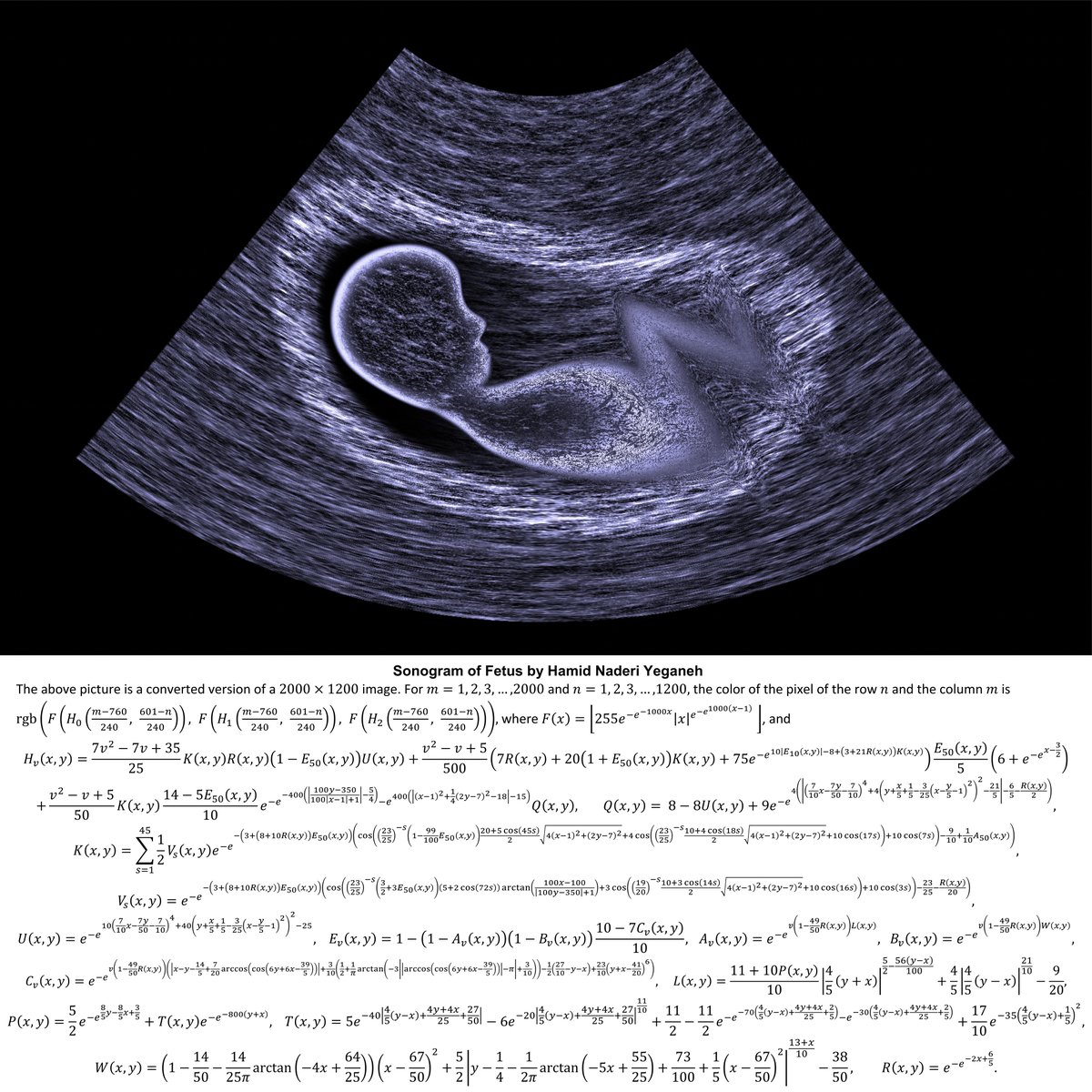 I drew this fetus ultrasound image with mathematical equations.