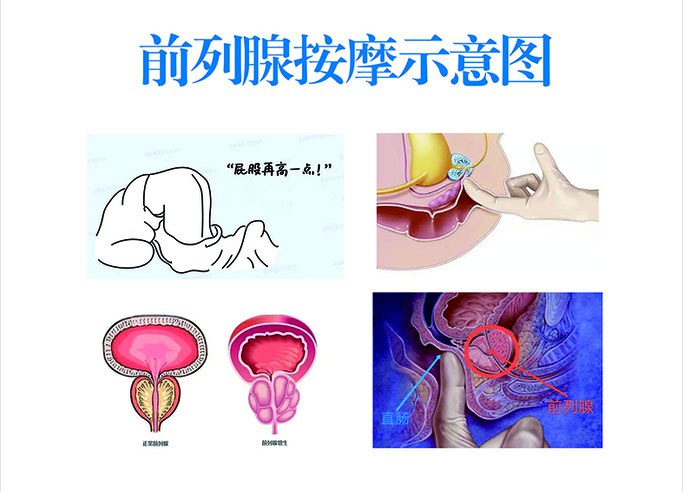 ingridomm's tweet photo. 男人的前列腺是一个重要脏器，是性器官的一部分，通过按摩引流前列腺液，去除肿胀，提高前列腺器官免疫能力，能够抵抗炎症，避免前列腺液影响精子活力，有助于改善前列腺的充血症状，可以帮助射精、保持腺管的通畅，对前列腺增生、肥大、钙化、淤血，炎症等有一定的功效。
V：SUYE7773 https://t.co/Q0V1QNtGMU