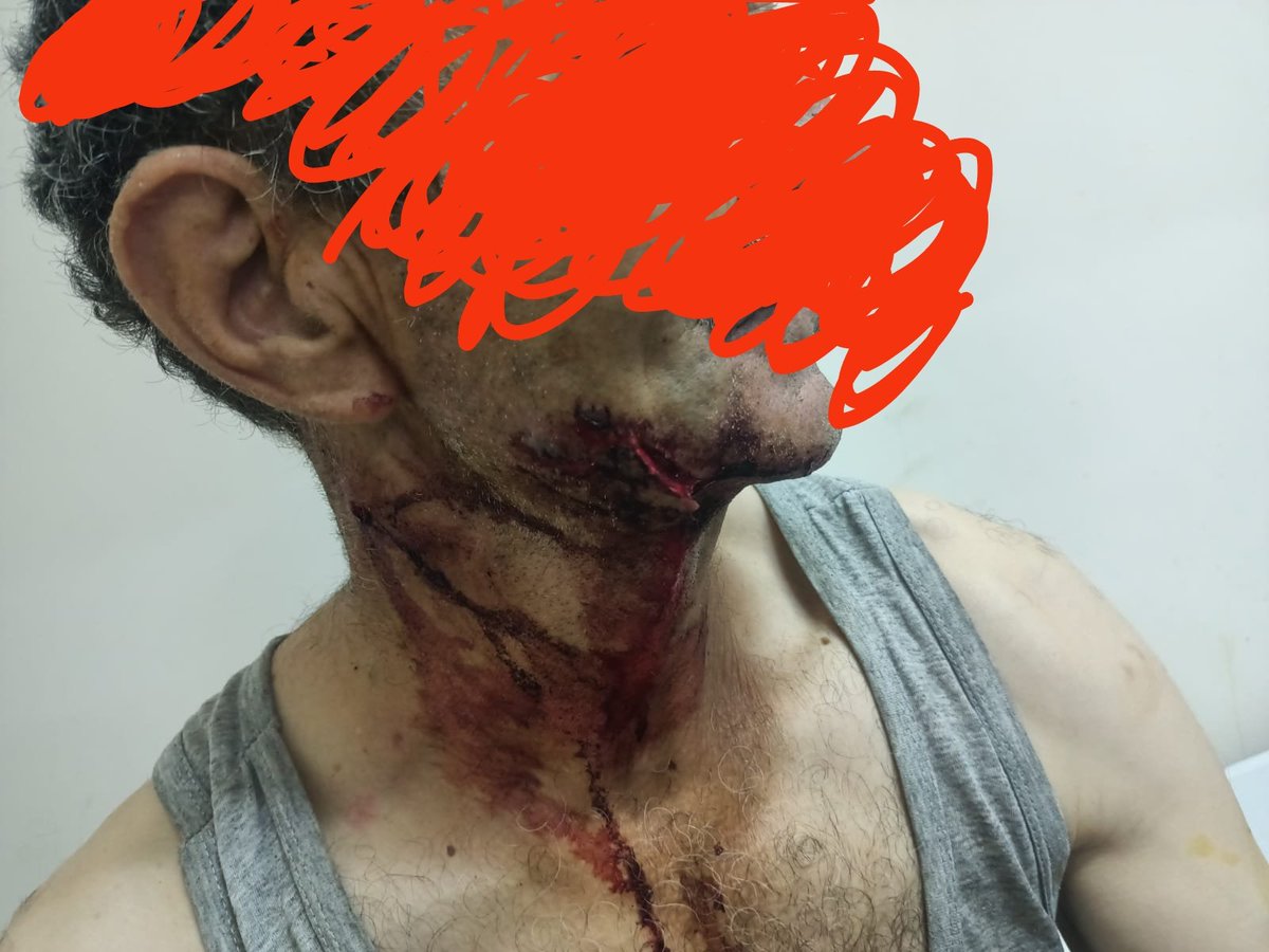 Vet.Hekim İsmail DEMİR (@vetdemir) on Twitter photo Gidişat iyi değil! Çok vahim sonuçlara gebe. Kontrolsüz başıboş köpeklerin sağlık takibi-aşısı ve parazit mücadelesi YAPILAMAZ! Önce insan ve #teksağlık için çocukların rahatça oynayabildiği parklar için,#SIFIRBAŞIBOŞKÖPEK. <a href="/tcbestepe/">T.C. Cumhurbaşkanlığı</a> <a href="/RTErdogan/">Recep Tayyip Erdoğan</a> <a href="/Yenisehirlioglu/">Bahadır Yenişehirlioğlu</a> <a href="/GuvenliSokaklar/">Güvenli Sokaklar Derneği</a> Gidişat iyi değil! Çok vahim sonuçlara gebe. Kontrolsüz başıboş köpeklerin sağlık takibi-aşısı ve parazit mücadelesi YAPILAMAZ! Önce insan ve #teksağlık için çocukların rahatça oynayabildiği parklar için,#SIFIRBAŞIBOŞKÖPEK. <a href="/tcbestepe/">T.C. Cumhurbaşkanlığı</a> <a href="/RTErdogan/">Recep Tayyip Erdoğan</a> <a href="/Yenisehirlioglu/">Bahadır Yenişehirlioğlu</a> <a href="/GuvenliSokaklar/">Güvenli Sokaklar Derneği</a>