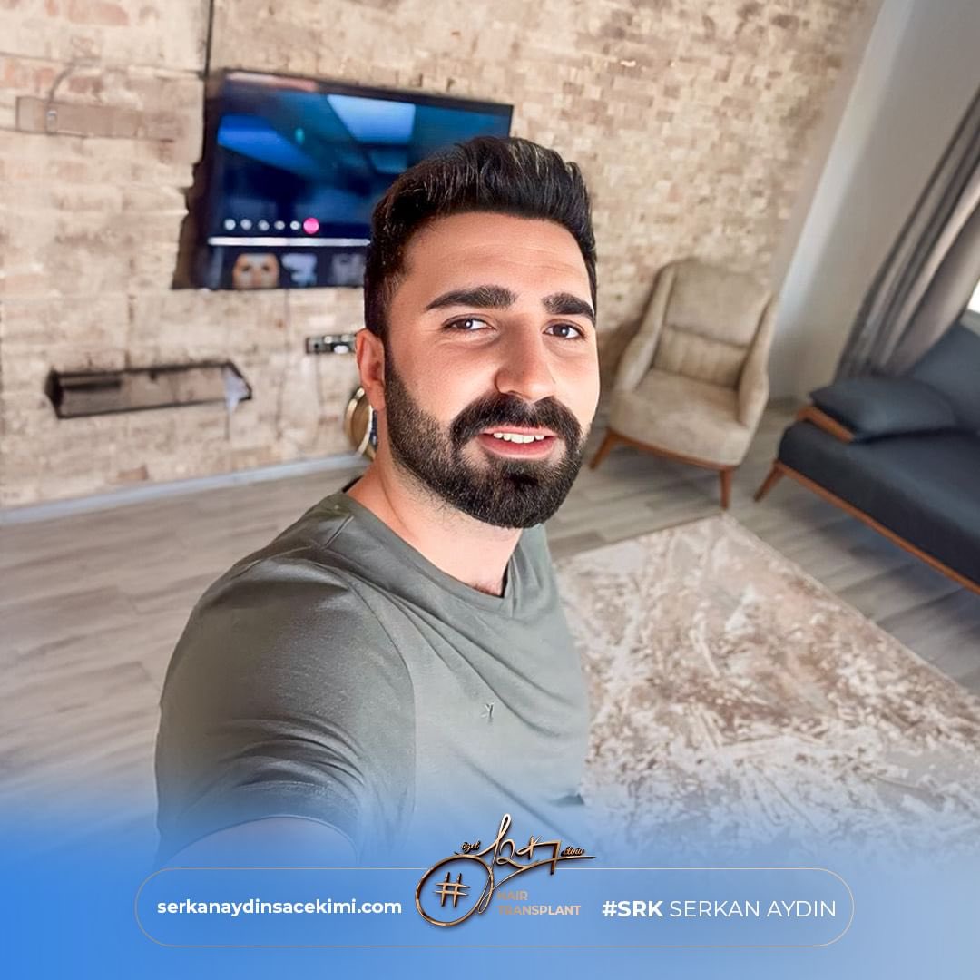 Arenamedd's tweet photo. Noch ein perfektes Ergebnis 😎
#mesutakdemir
Kontaktieren Sie uns für kostenlos Haaranalyse 📱

#serkanaydin #maximumgrafts #hairtransplant #beardtransplant #stemcell #haartransplant #Stammzellen #maximalgraft #maximaktrans#serkanaydin #maximumgrafts #hairtransplant https://t.co/0D4xZVhv8e