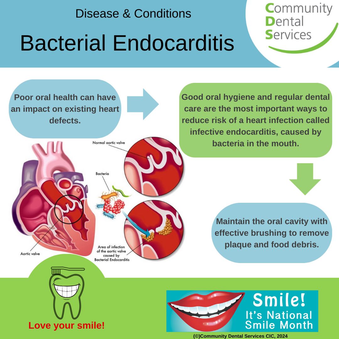 Poor oral health can impact existing heart defects. Good oral hygiene and regular dental care are important ways to reduce risk of infective endocarditis, caused by bacteria in the mouth. Maintaining good oral health, will help with general health. #OHImprovement #SMILEMONTH