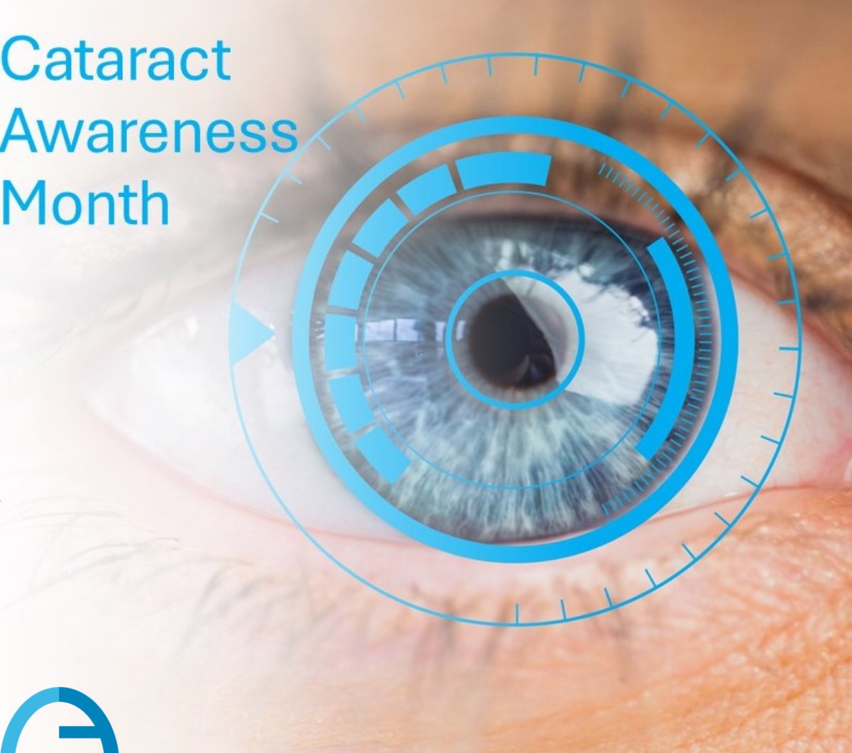 June is the month dedicated to raise awareness on #cataract. #Earlydiagnoses on this condition is essential, and can be recognised with Anterior Segment Screening function, a complete AI system cloud based for cataract and #keratoconus #screening, with our 2WIN-S Plus.