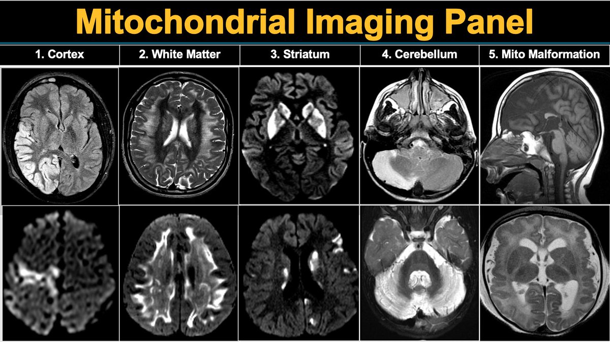 How comfortable do you feel about the diagnosis of these imaging findings? @ESPRSociety @cure_mito let's organize it!!!
