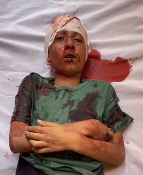 free palestine tweet media