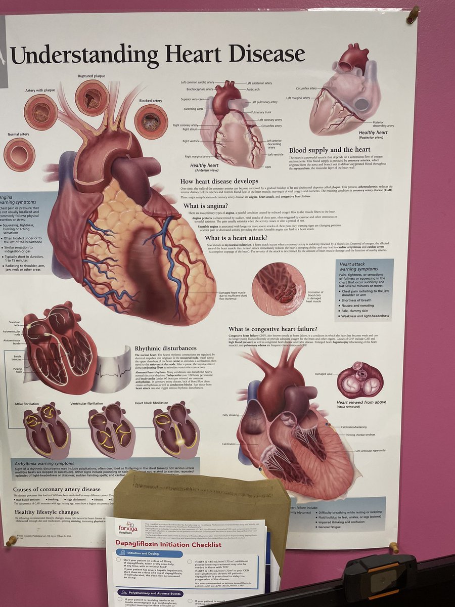 Bernadette Thompson OBE (@bj_thompson1) on Twitter photo Visited <a href="/KingsCollegeNHS/">King's College NHS</a> Cardio, so impressed by the amazing team at the Heart Failure Ambulatory Unit! Huge thanks to Hannah Simmons, Dr Sue Piper, and Dr Antonio Cannata for their dedication. Catching heart failure early is crucial! #HeartHealth #EarlyDetection #CardioCare Visited <a href="/KingsCollegeNHS/">King's College NHS</a> Cardio, so impressed by the amazing team at the Heart Failure Ambulatory Unit! Huge thanks to Hannah Simmons, Dr Sue Piper, and Dr Antonio Cannata for their dedication. Catching heart failure early is crucial! #HeartHealth #EarlyDetection #CardioCare