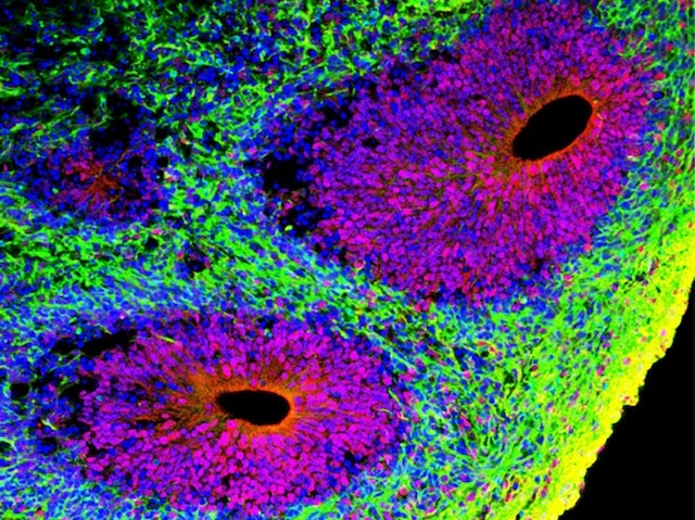 BPoD_s's tweet photo. A method for #cryopreserving #brain #organoids while maintaining architecture & function on thawing increases study versatility. Image & research by Weiwei Xue et al @FudanUni in @CellReports. On https://t.co/GSK8bVpkoH where you'll find links & a great big searchable archive! https://t.co/DVudIfmOdk