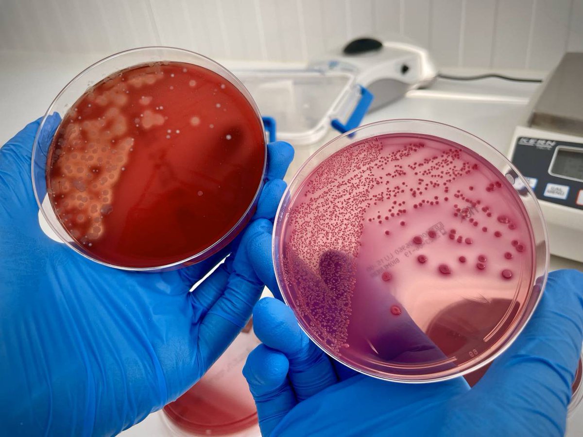 En la actualidad “hay más de 450 ensayos clínicos activos con trasplante de microbiota humana para diversas patologías”, destaca la microbióloga Andrea Aira del <a href="/hospitalclinic/">Hospital Clínic</a> 

✍️ <a href="/saez_cristina/">Cristina Sáez</a> 

🧫 agenciasinc.es/Reportajes/Cua…