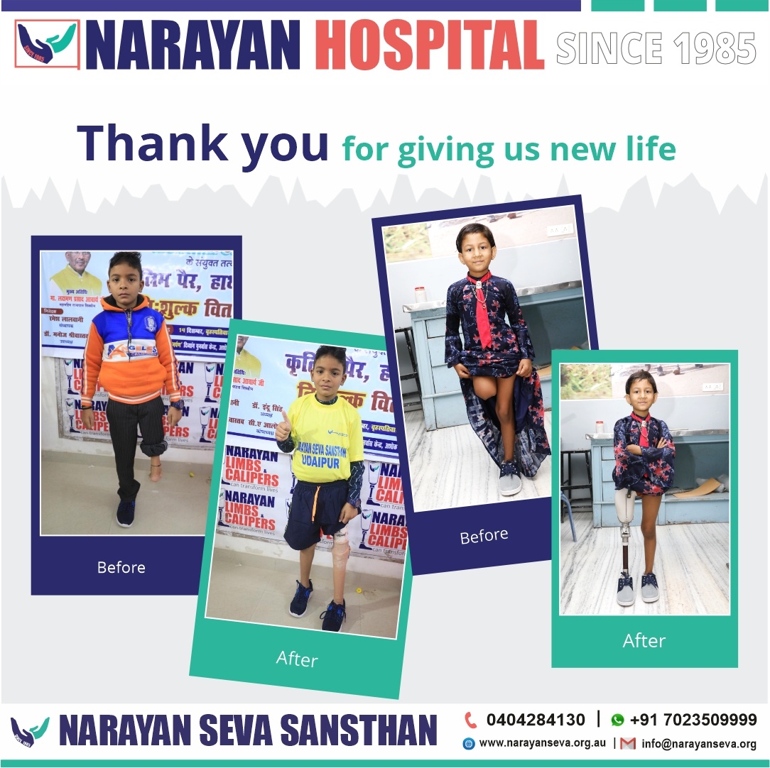 narayansevaaus's tweet photo. Gratitude for transforming lives through corrective surgery. Your support makes a profound difference in restoring hope and health. Thank you for changing lives! 🙏💙 
.
.
#Gratitude #LifeChanging #CorrectiveSurgery #RestoringHope #RestoringHealth #ThankYou #SupportMatters https://t.co/L8Vv2N1S2k