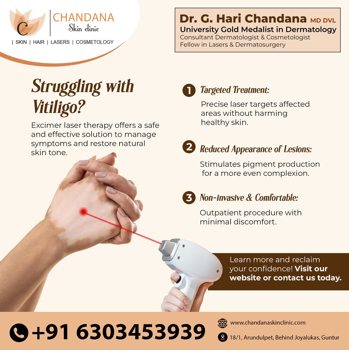 chandanaskincl1's tweet image. Vitiligo causing you concern? There's hope! Excimer laser therapy targets affected areas, promoting repigmentation for a more even skin tone. It's a safe, non-invasive option to manage symptoms.

#vitiligo #vitiligotreatment #repigmentation #guntur #chandanaskinclinic
