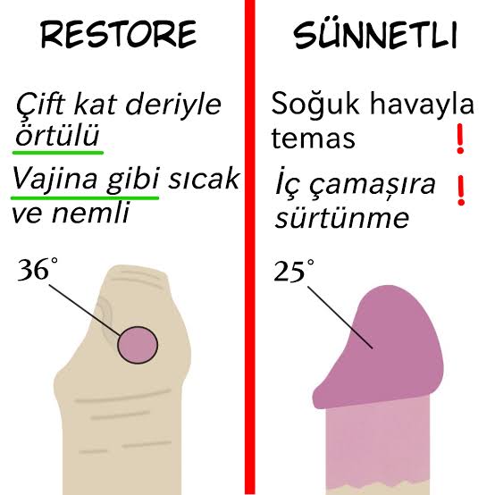Sünnetsiz olsaydık cinsellikten çok daha fazla zevk alacaktık. Çünkü sünnet, hassas olan penisin ucunu duyarsızlaştırıyor. Erken boşalmaya sebep oluyor. Karşı cinste vajinismusu tetikliyor.

Ayrıca: