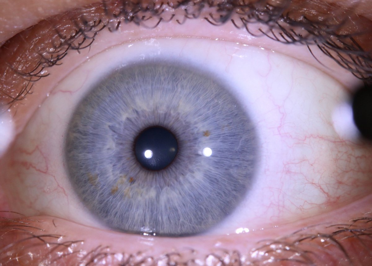 irislabltd's tweet photo. Enhance your practice with IrisLab's advanced iriscopes. Designed for precision and ease of use. Contact us for more details! https://t.co/4R48K6Sq2f

#IrisLabInnovation
#AdvancedIriscopes
#EyeCareExcellence https://t.co/CTgTKy91xK