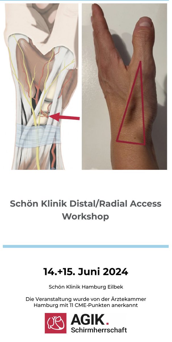 KardiologieHH's tweet photo. #DistalRadialFirst / #Snuffbox Course
🎯Distal/ Radial Access Workshop
🗓️ 14. Juni + 15. Juni 2024
📌Schön Klinik Hamburg

‼️Noch WENIGE freie Plätze frei‼️
⬇️Jetzt buchen⬇️

Registrierungslink+Programm:
🔗https://t.co/lv404FlXuu https://t.co/R1j63GY1bM
