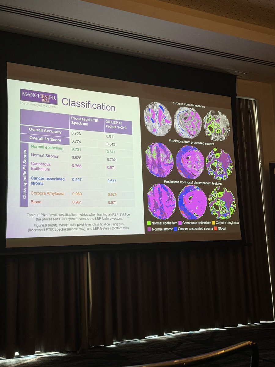 Anas_cit's tweet image. Just attended the Advances in #Data_Science and #AI Conference 2024 at the University of Manchester! The sessions on AI in medicine were incredibly insightful, showcasing the transformative potential of AI in #healthcare. 

#IDSAI2024 #HealthcareAI #AIMedicine