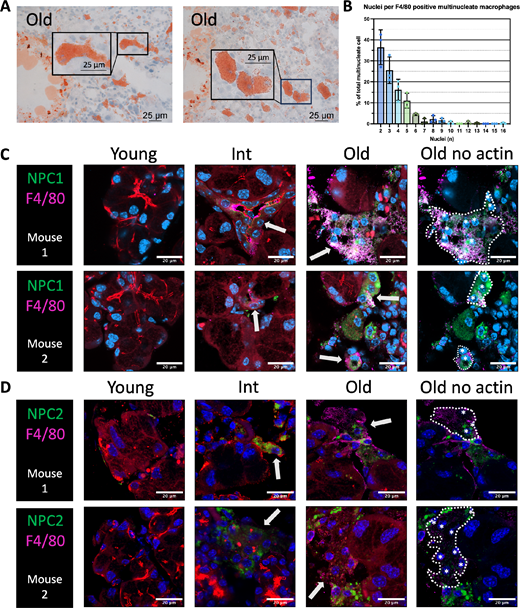 ARVOiovs's tweet photo. Sarah Hamm-Alvarez and Cintia de Paiva et al. @USCEye @USCMann @de_Paiva_Lab @BCMEye
find that The Aging Lacrimal Gland of Female C57BL/6J Mice Exhibits Multinucleate Macrophage Infiltration Associated With Lipid Dysregulation, https://t.co/PEmOj9FmAy. https://t.co/DkwElbOuDt