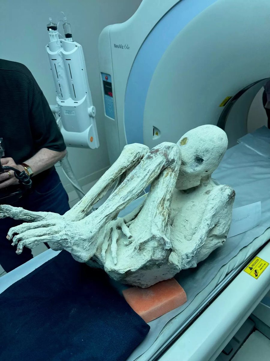 Robin081564's tweet photo. It’s ironic that I thought UFOlogy would get behind the Nazca Mummy story and force the Scientific community to accept and acknowledge the reality of the situation. But here we are a several years later and it looks like it is gonna be the other way around. 😂
#ufotwitter https://t.co/k98tV5421L