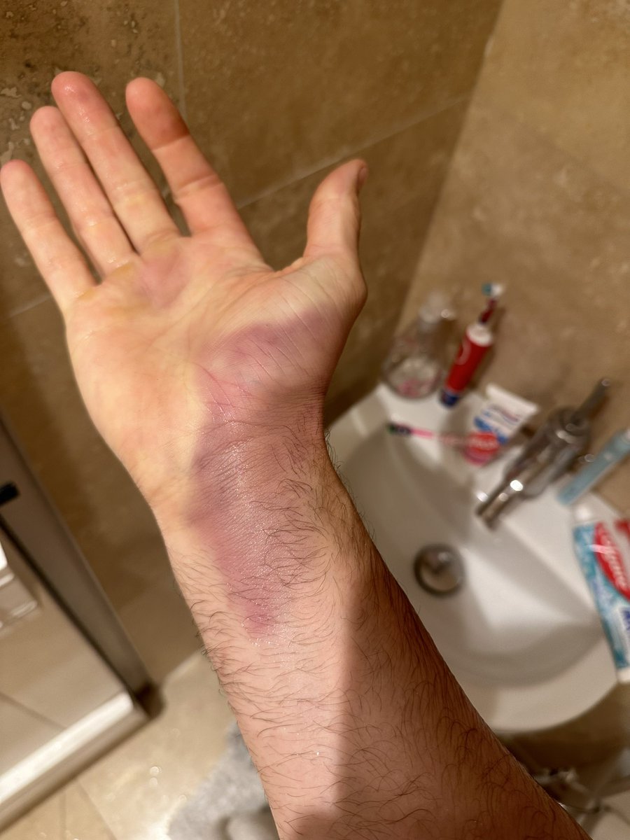 BenoitJWB's tweet photo. @spondoncc @ThatsSoVillage Here’s the result haha. We didn’t leave him I did say do you need help and he said was ok. https://t.co/QQPZ6DSuHy