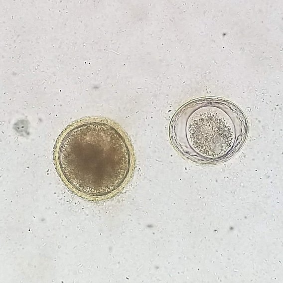 Vet_Parasites's tweet photo. Toxocara canis ovum on the left and Toxascaris leonina ovum on the right, from a canine fecal float. These there the two most common roundworms I see in canines in America #parasitology #parasite #vet #veterinary #vetlife #vetmed #veterinaria #roundworms #microscope #veterinario https://t.co/BsD5p6gKZx