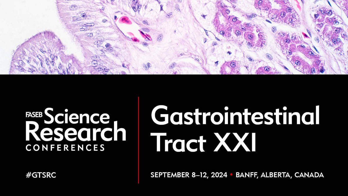 FASEB (@faseborg) on Twitter photo Get ready for GI Tract 21! We have an amazing speaker, <a href="/ThiruKanneganti/">Thirumala-Devi Kanneganti</a> from <a href="/StJudeResearch/">St. Jude Research</a>. Organizers <a href="/OrganoidDiva/">Sarah Blutt</a>, <a href="/EdelblumLab/">Edelblum Lab</a>, and <a href="/magnesslab/">Magness Lab</a> have created a comprehensive program on GI diseases. Check out the agenda for #GTSRC and save your space: hubs.ly/Q02z5P6M0 Get ready for GI Tract 21! We have an amazing speaker, <a href="/ThiruKanneganti/">Thirumala-Devi Kanneganti</a> from <a href="/StJudeResearch/">St. Jude Research</a>. Organizers <a href="/OrganoidDiva/">Sarah Blutt</a>, <a href="/EdelblumLab/">Edelblum Lab</a>, and <a href="/magnesslab/">Magness Lab</a> have created a comprehensive program on GI diseases. Check out the agenda for #GTSRC and save your space: hubs.ly/Q02z5P6M0