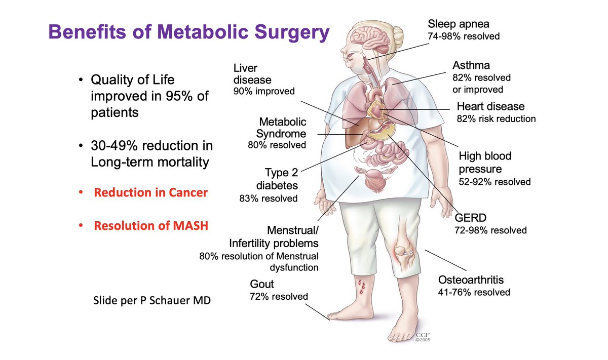 Philip Schauer, MD tweet media