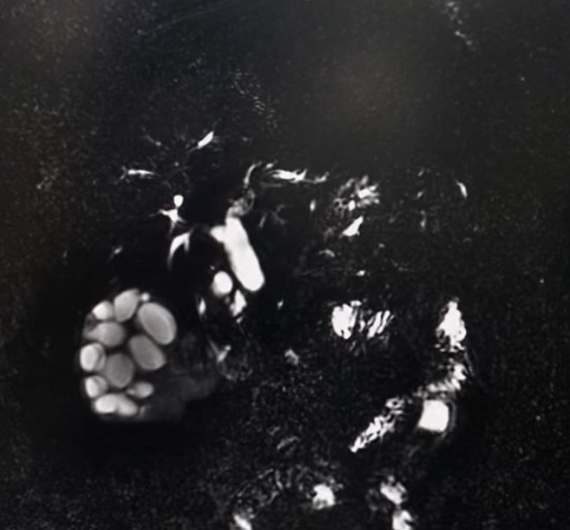 أحب الـ MRI ومبسوطة في حالاته كثير  ❤️
وخصوصًا فحوصات ال Abdomen + pelvis
- شهر ممتع بالحالات اللي تعلمتها ✨