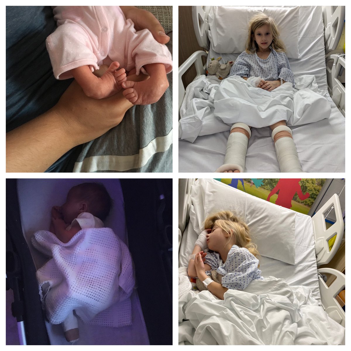 LeanneSmartie's tweet photo. #WorldClubfootDay Erin’s journey! https://t.co/t9jbeCkmd5