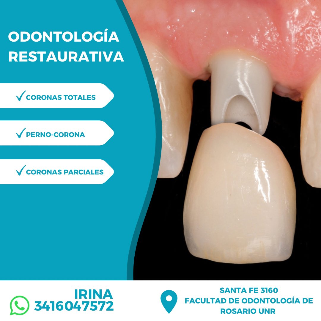 🦷 Necesitas realizarte una corona dental, una incrustación o pernos-corona definitivos/provisorios? Nosotros podemos ayudarte!
📞 Consultanos por WhatsApp 3416047572
📍 Santa Fe 3160 - Facultad de Odontología de Rosario
🤝🏼 Horario de atención: miércoles por la mañana