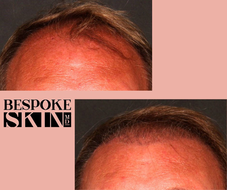 Bespoke Skin MD tweet media