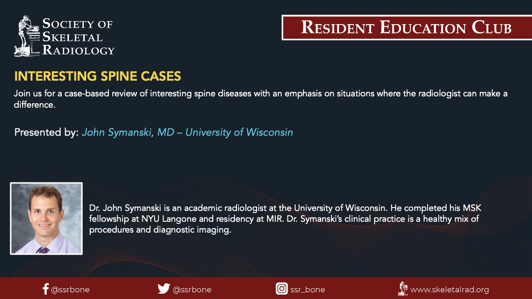 UW MSK Imaging & Intervention (@uw_mskrad) on Twitter photo Excited to announce that our very own <a href="/JohnSymanski/">John Symanski</a> will be showcasing "Interesting Spine Cases" for <a href="/ssr_rwg/">SSR_RWG</a> next Wednesday night, June 12th‼️ 📅🧠🩻 #RadEd #FOAMRad #MSKSpine #MedEd <a href="/UWRadRes/">UWisconsin Radiology Residents</a> <a href="/UWiscRadiology/">UW Radiology</a>
Sign up: veritasamc.zoom.us/webinar/regist… Excited to announce that our very own <a href="/JohnSymanski/">John Symanski</a> will be showcasing "Interesting Spine Cases" for <a href="/ssr_rwg/">SSR_RWG</a> next Wednesday night, June 12th‼️ 📅🧠🩻 #RadEd #FOAMRad #MSKSpine #MedEd <a href="/UWRadRes/">UWisconsin Radiology Residents</a> <a href="/UWiscRadiology/">UW Radiology</a>
Sign up: veritasamc.zoom.us/webinar/regist…