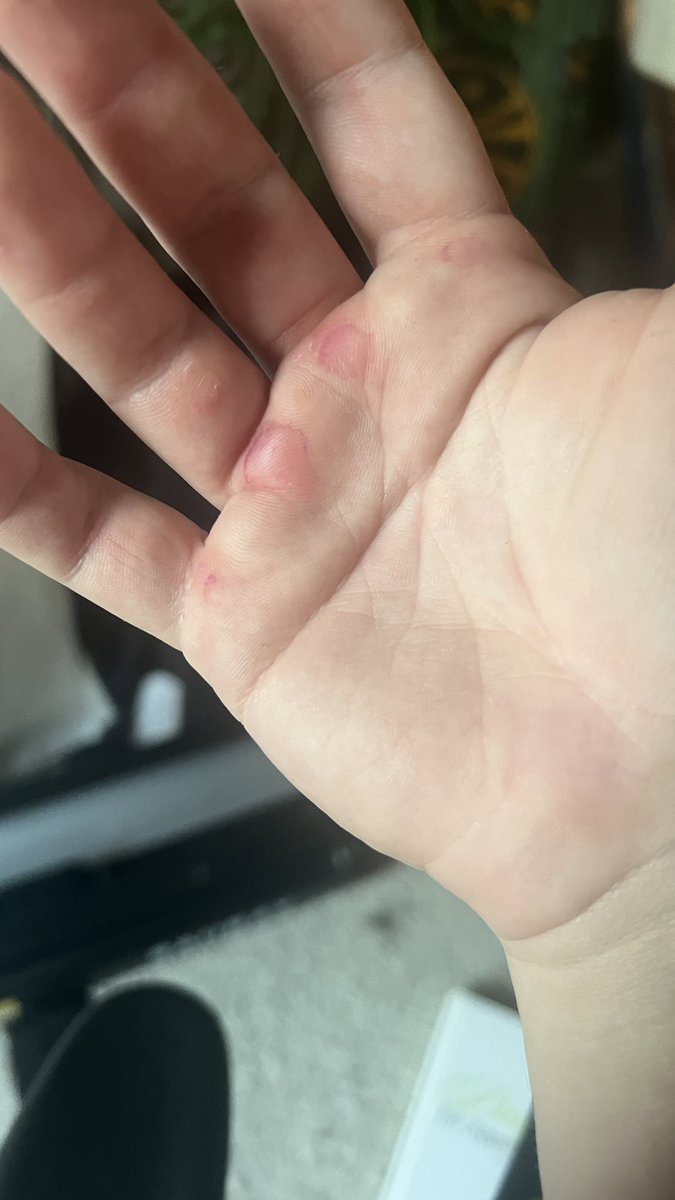 She-Rage, Princess of Pain tweet media