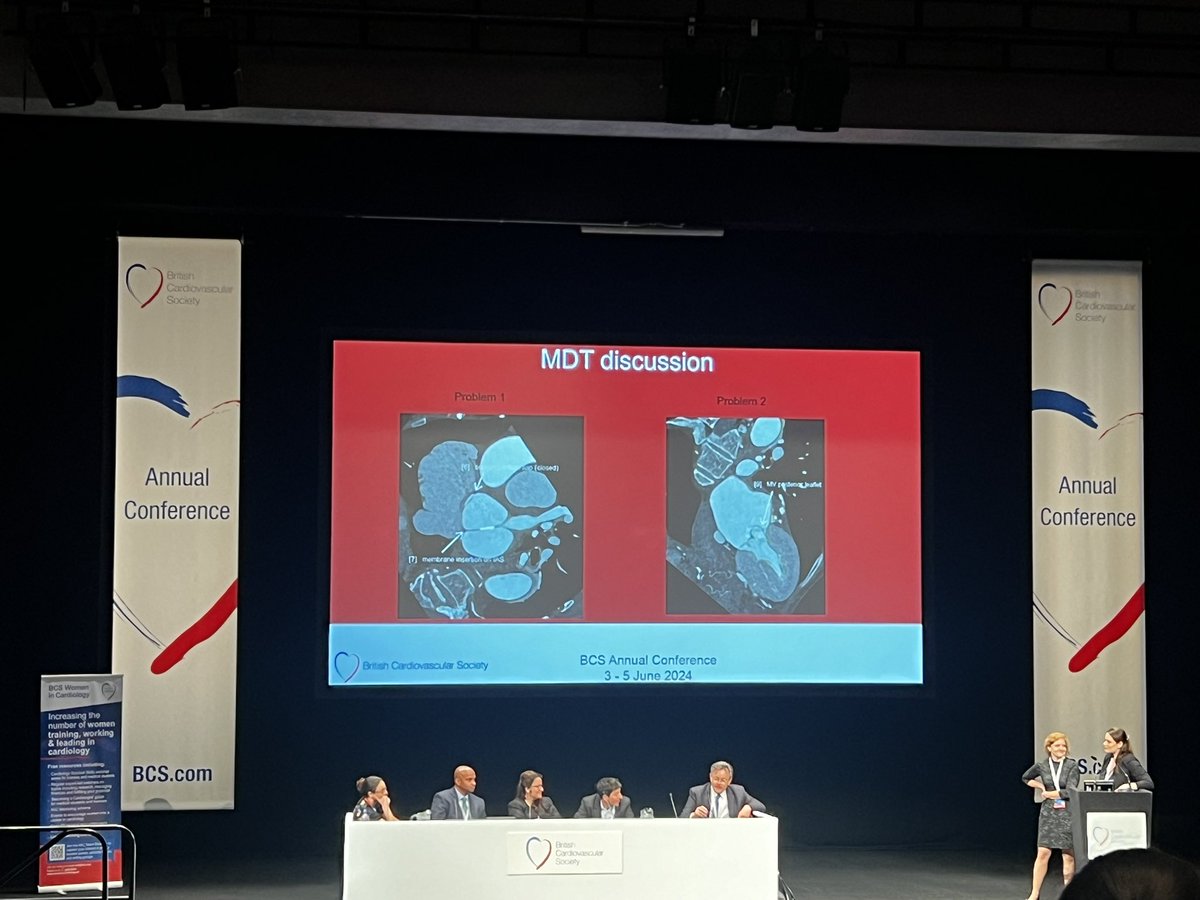 Live Imaging MDT #day2 #BCS2024

Beautiful cases including this case of severe MR in an elderly, frail patient with CT assessment prior to TEER, demonstrating severe MV prolapse and cortriatrium. 
@erica_tirr #whyCT @sado_dan @DanXAugustine @guyll @Reidmeanna